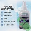 SkinSmart's powerful ingredients fight skin infections, offering a safe and effective daily facial cleanser.