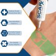 Medical-grade silicone gel provides a professional approach to treating hypertrophic scars, burns, and surgery scars.
