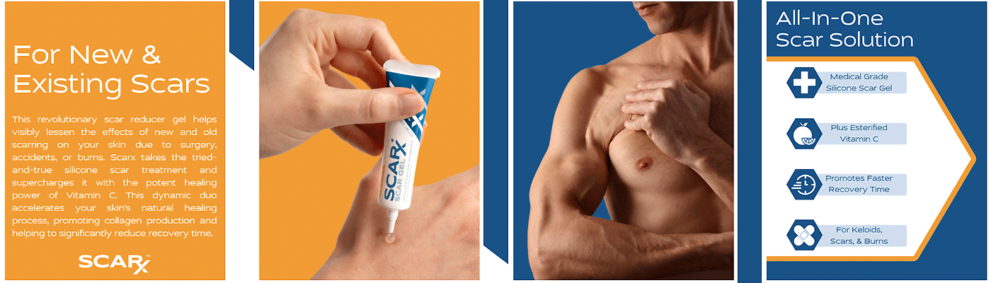 Medical-grade silicone gel provides a professional approach to treating hypertrophic scars, burns, and surgery scars.